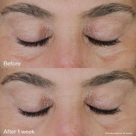 کرم دور چشم لیفت کننده شیسیدو Vital Perfection