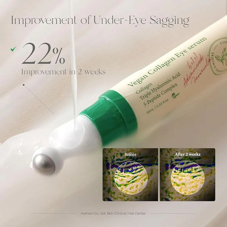 سرم دور چشم ضد چروک و روشن کننده کلاژن اکسیس وای 10ml