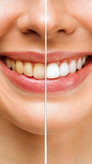 خمیردندان سنسوداین اصلی مدل deep clean gelpaste